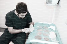hair transplant cost