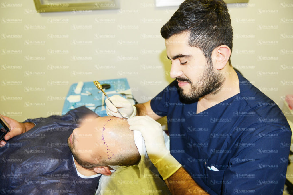 hair transplant reviews